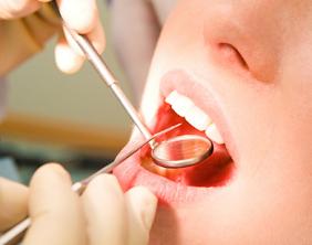 Some Healthy Foods Can Still Be Bad for Your Teeth