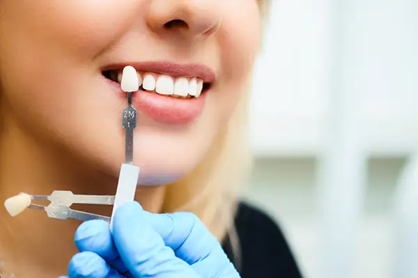 A close-up of a woman's bright and healthy smile, emphasizing straight white teeth and oral hygiene.