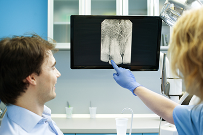 How Digital Radiography Is Changing the Face of Dentistry?